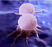 کشف چگونگی گسترش سرطان سینه