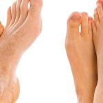 لیزر موهای زائد هونام تجهیز