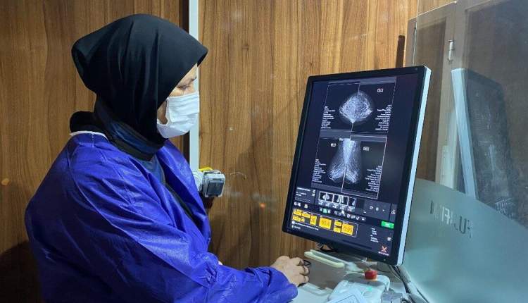 ماموگرافی رایگان زنان در سراسر کشور از 26 مهر تا 3 آبان ماه